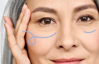 a woman with puffy eyes